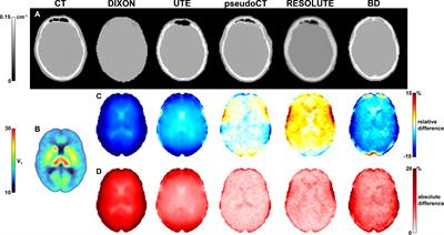 Attenuation Correction Approaches for Serotonin Transporter Quantification With PET/MRI